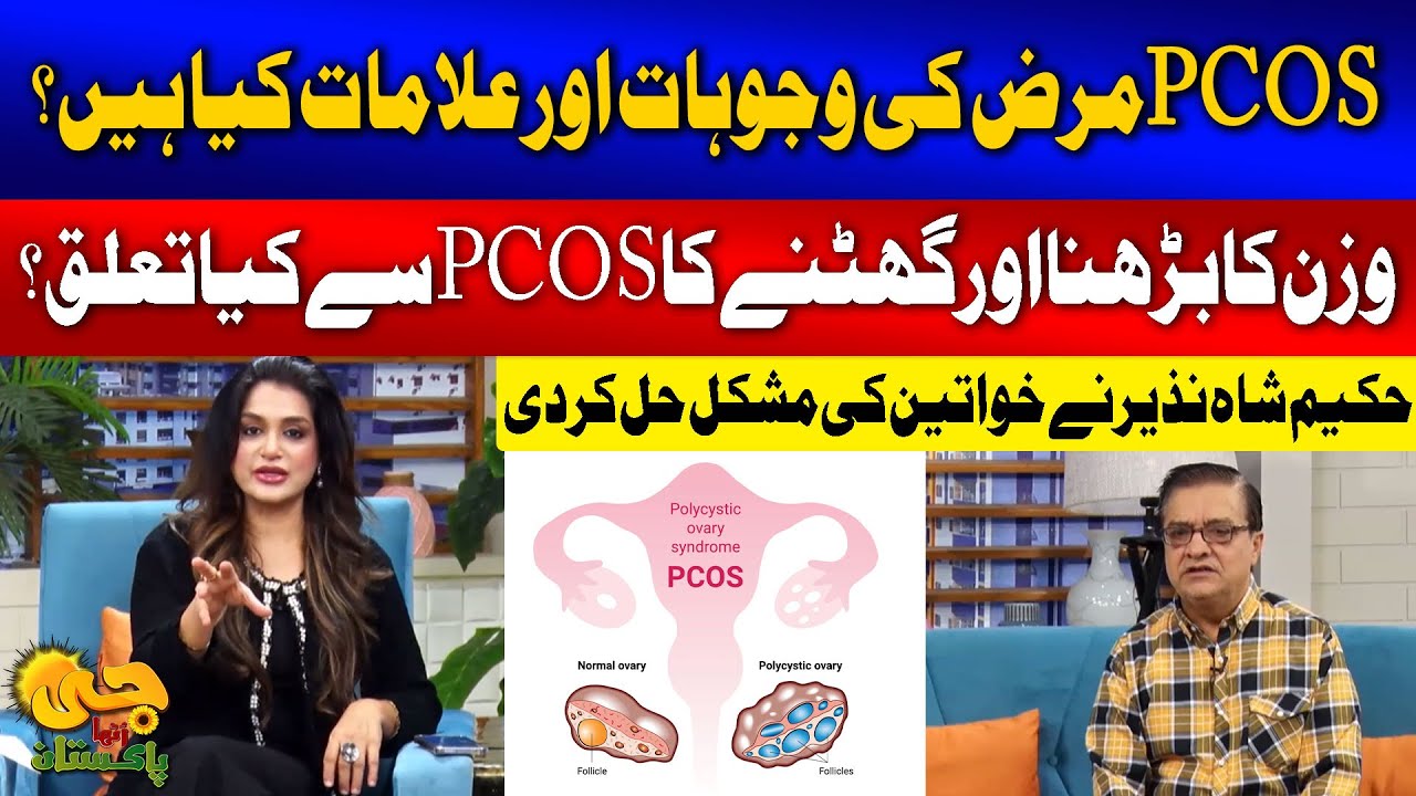 PCOS-Causes and Treatment | Connection b/w PCOS and Weight gain| Hakeem Shah Nazir | G Utha Pakistan