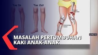 Cara Mencegah Kelainan Bentuk Kaki Bayi dan Anak-anak