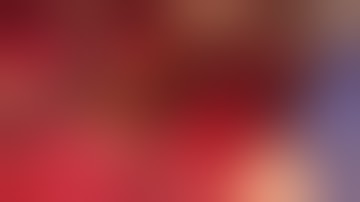 RE-HEPATECTOMY segment IV