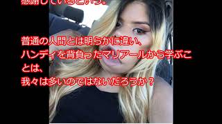 染色体異常 猿顔になってしまった女性 Youtube