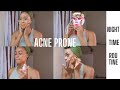 NIGHTTIME SKINCARE ROUTINE FOR OILY/ACNE PRONE SKIN &amp; HYPERPIGMENTATION ft Elf, Caudalie, Foreo etc