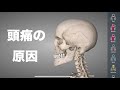 頭痛の原因は場所によって違う!それぞれの原因を解説!