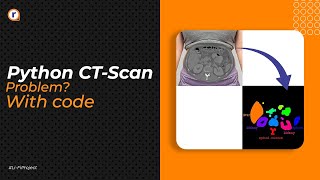 Solving Python CTScan Problem.