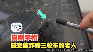 【1818黄金眼】自己敲断手指碰瓷！涉案金额达40多万！