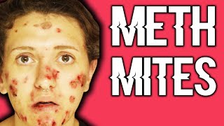 What Are Meth Mites & Why Do They Occur?