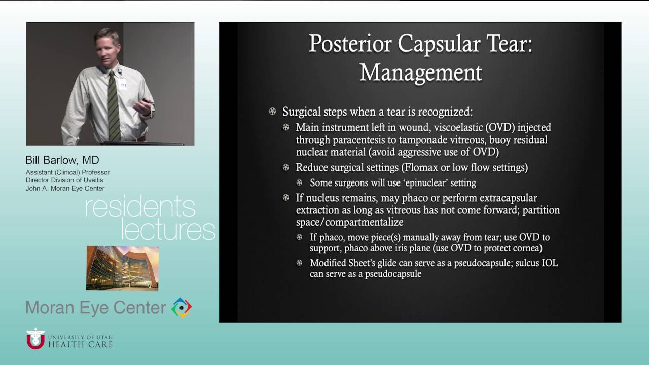http://clinicaltrials.gov Complications of Cataract Surgery