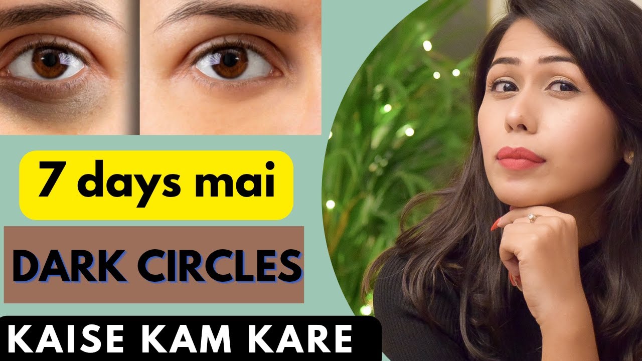 How to Remove dark circle in 7 days/Home remedies for dark circle/ 