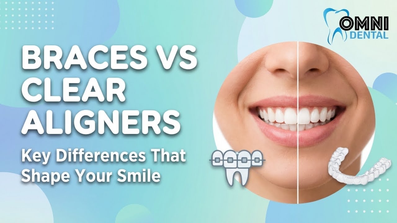 Braces vs Clear Aligners | Which Is Right for Your Smile? - YouTube