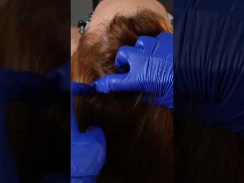 Asmr scalp check with crinkly gloves #shorts #asmrshorts