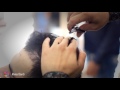 Hama barber 2