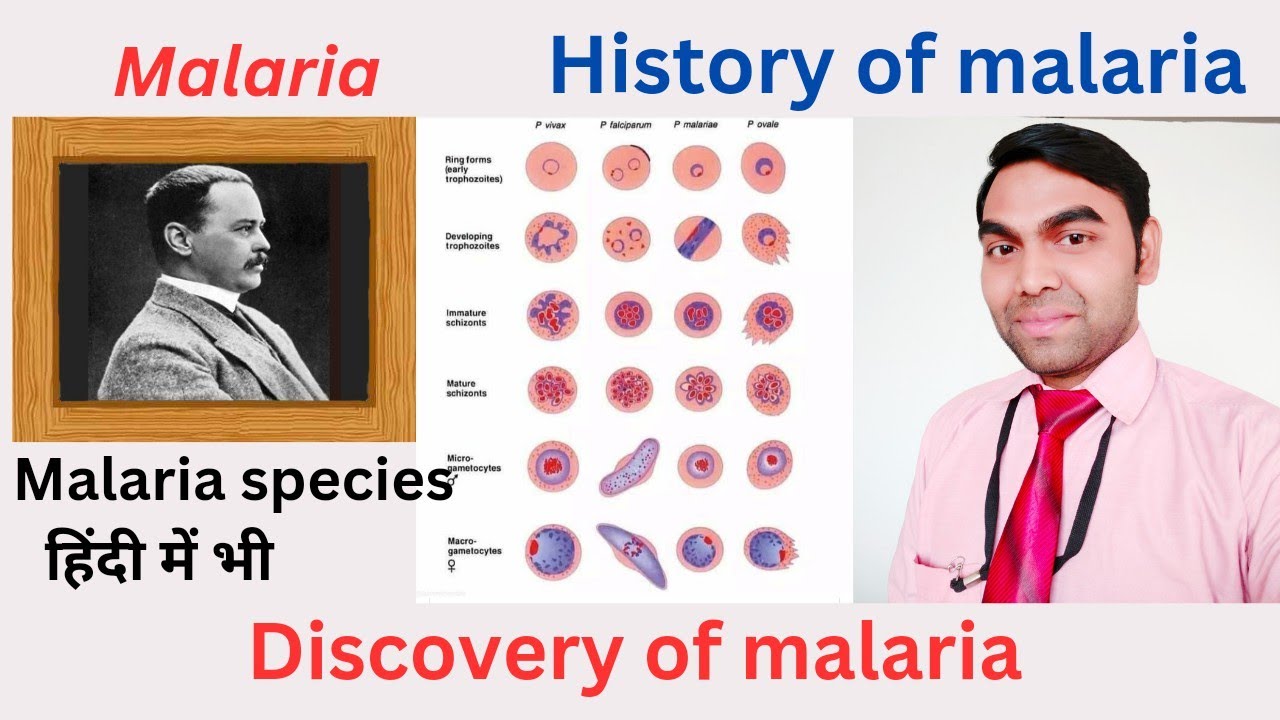 Malaria