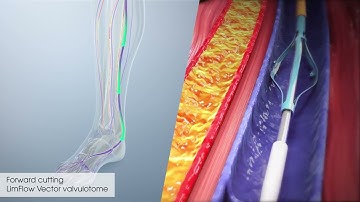 LimFlow Procedure Animation