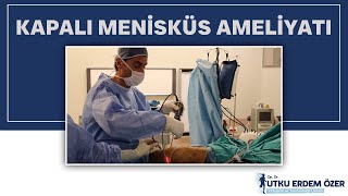 KAPALI MENİSKÜS AMELİYATI