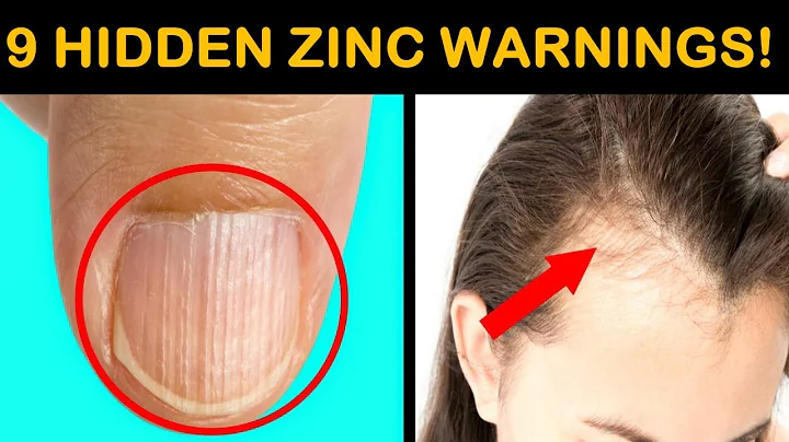9 signs your Body is begging for Zinc