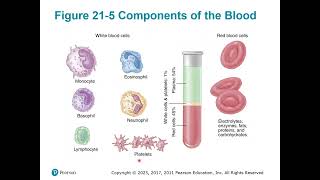 Chapter 21 Cardiovascular Disorders
