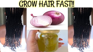 HOW I USE ONION OIL FOR FASTER HAIR GROWTH & STOP HAIR FALL/ BALDING |HOW TO MAKE ONION HAIR OIL