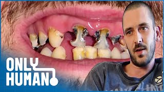 I Haven't Visited the Dentist in 10 Years | Britain's Worst Teeth | Only Human