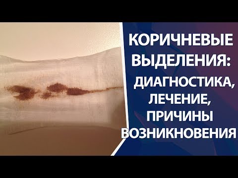 Видео: Грязевые мазни черные?