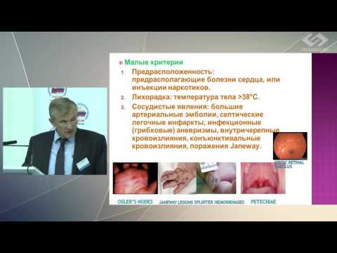 А.А. Кишкун – Современные критерии диагностики инфекционного эндокардита