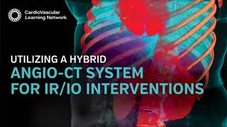 Utilizing A Hybrid Angio-CT System for IR/IO Interventions screenshot 4