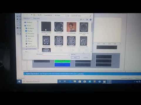 Digital Image Processing