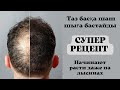 ШАШТЫҢ ТҮСУІ МЕН ТАЗ БОЛУЫН ТОҚТАТАДЫ. ЖАҢА ШАШТЫҢ ШЫҒУЫНА КӨМЕКТЕСЕДІ.