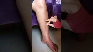 Download Lagu Teknik Menusuk Jarum Akupunktur dengan Jarum Panjang, 3 Cun MP3