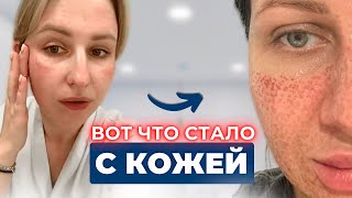 Сделала все ТОПОВЫЕ процедуры у косметолога и ПОЖАЛЕЛА!