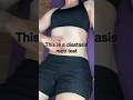 STOP Doing Crunches If You Have Diastasis Recti 😳 #shorts
