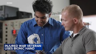 Bionic hand helps retired injured war veteran feel what he touches