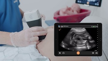 Gender Identification - Ultrasound Scanning Technique