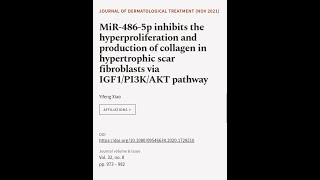MiR-486-5p inhibits the hyperproliferation and production of collagen in hypertrophic | RTCL.TV
