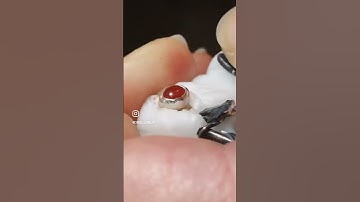 Stone setting in silver by @CirkelJewelry #jewelrymaking #stonesetting #engaste #metalsmithing #