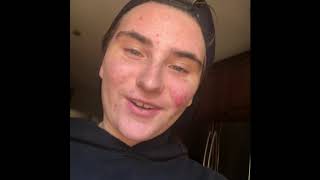 TAKING MY SNAKE OUTSIDE FOR THE FIRST TIME