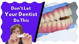 Impressions For Dentures