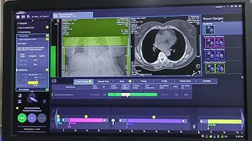 tri phasic ct siemens go now