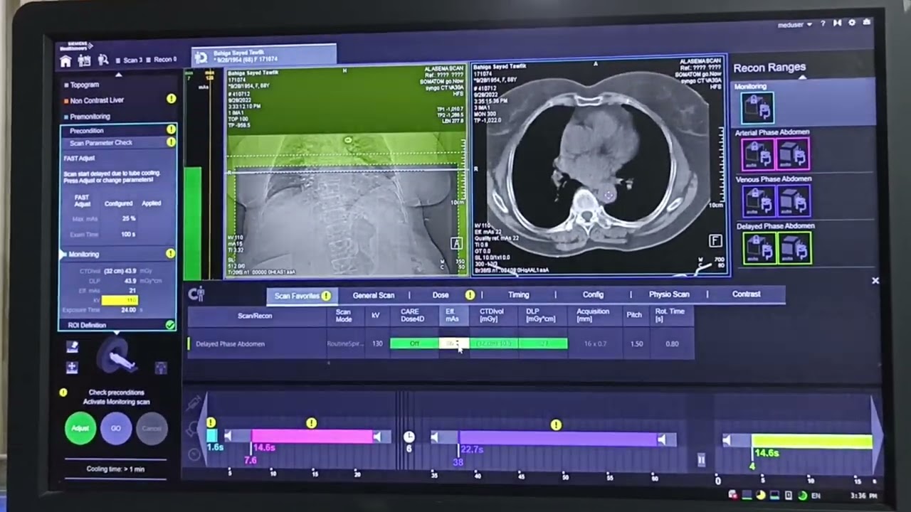 tri phasic ct siemens go now