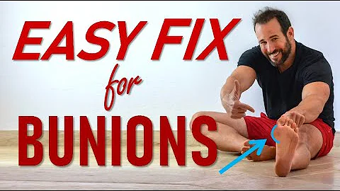 Get Rid Of Those Bunions w/ Dr. Yoni Whitten
