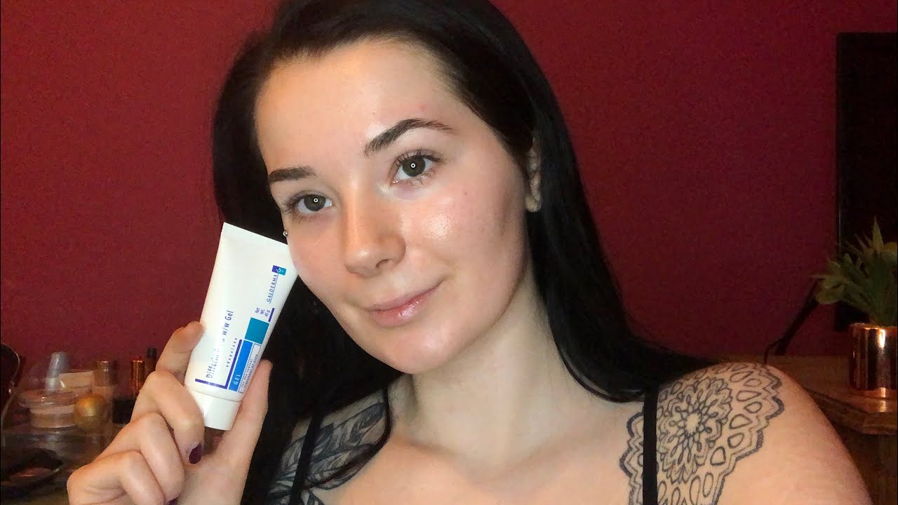 10 MONTH DIFFERIN UPDATE | What my skin looks like now!