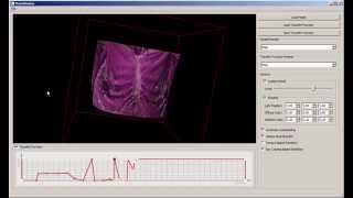 Direct rendering of volumetric data via volume ray casting and texture slicing