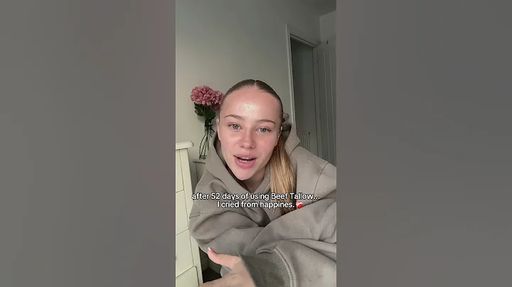 You won't believe how I healed my skin… 😱