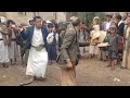 شاهد وضحك من قلبك رقصة برع مع فنان توفيق الماخذي