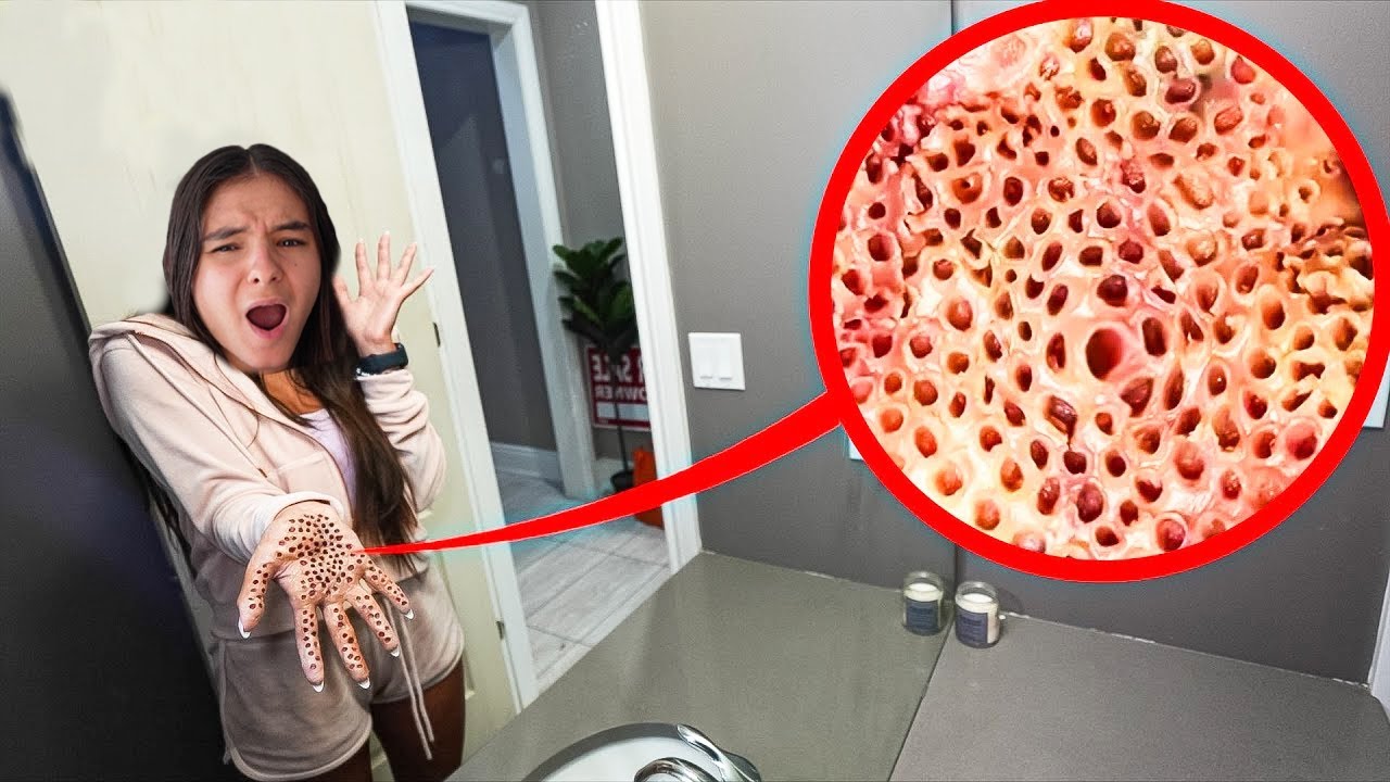 SI VOUS VOYEZ DES TROUS SE FORMER SUR VOTRE MAIN, COUREZ ! (YASPOOKY EST MALADE...)