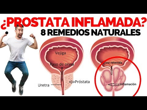 prostatitis bacteriana crónica remedios naturalización