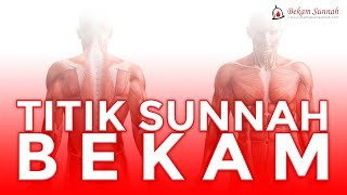 9 Titik Bekam Sunnah Yang Perlu Diketahui ! screenshot 3