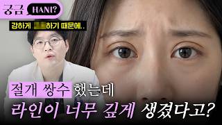절개쌍수 라인이 깊다면 쇼츠