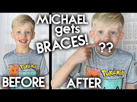 MICHAEL GETS BRACES!! + Family Vlog