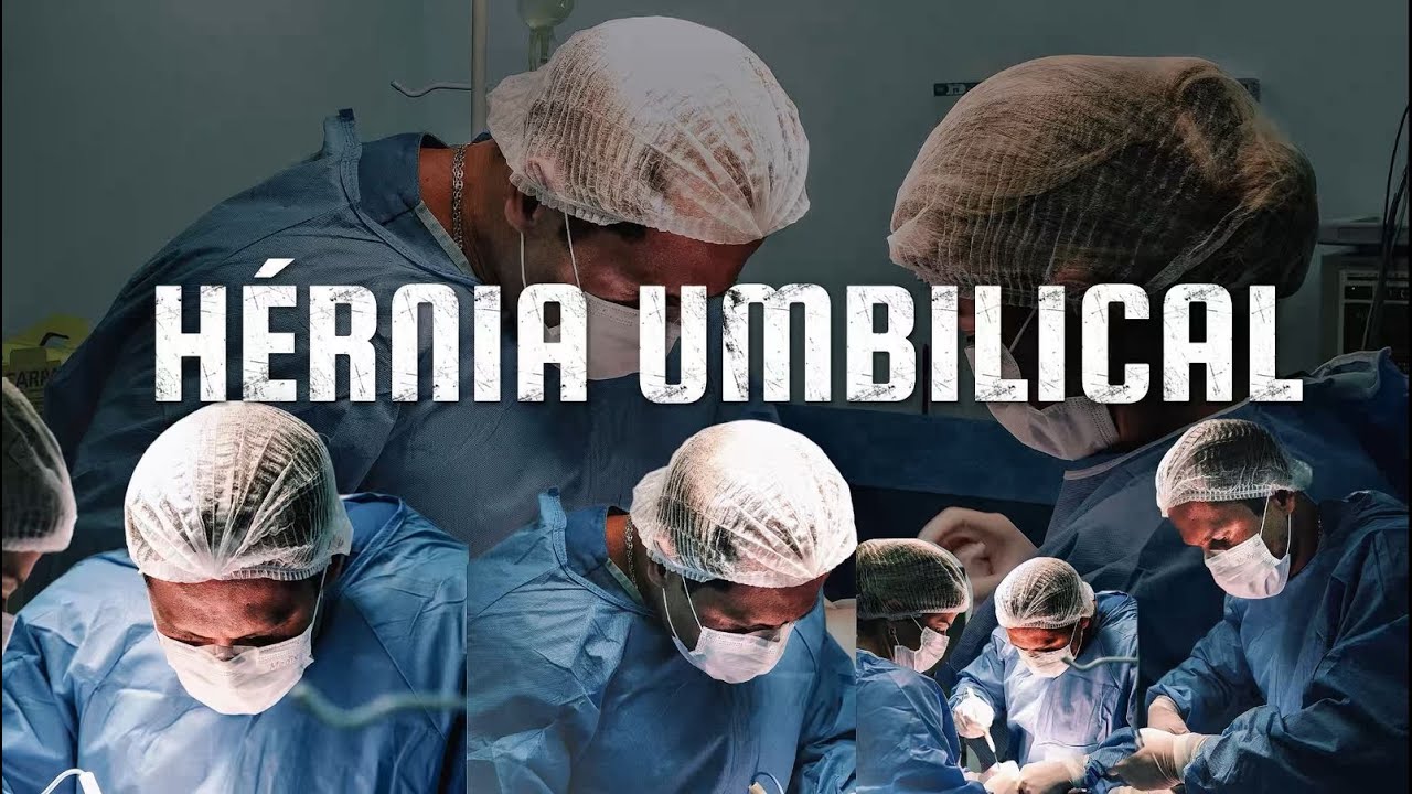 Cirurgia de Hérnia Umbilical na prática | Veja como é feita a correção ...