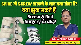 कय रढ क हडड म सकर और रड लगन क बद झक सकत ह? Dr. Gireesh Gupta Explained