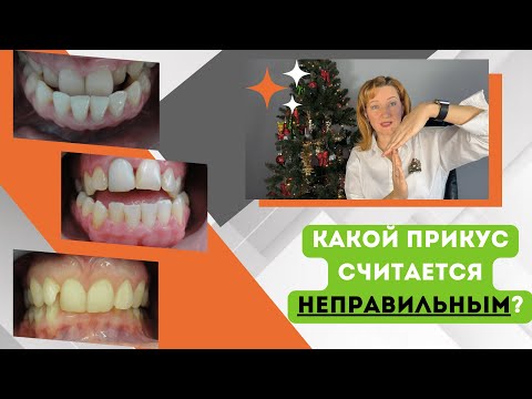 Какой прикус считается